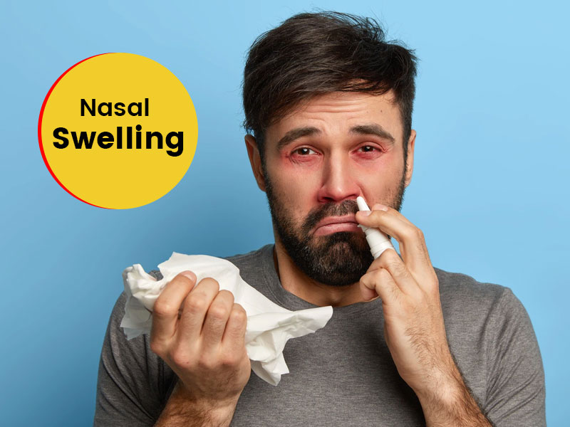 Nose Swelling: Symptoms, Causes And How Can It Be Treated?